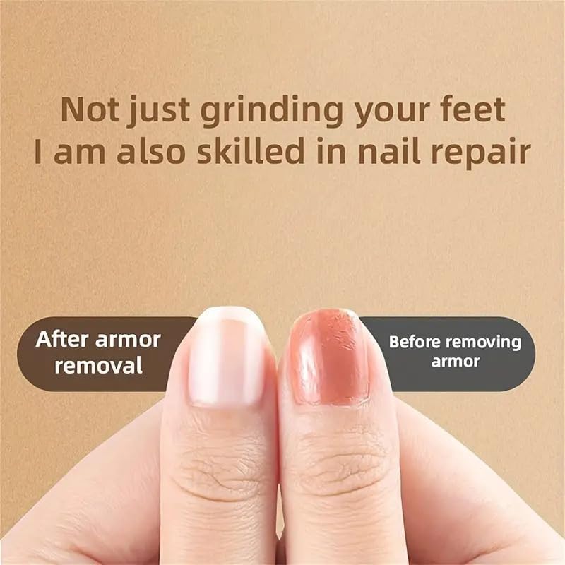 Electric Callus Remover