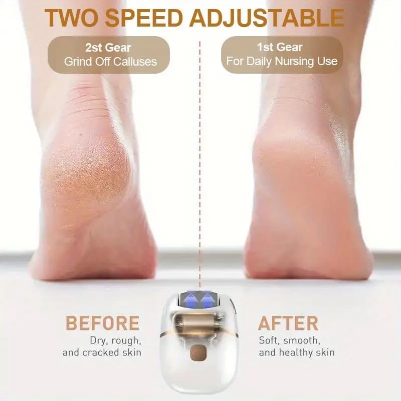 Electric Callus Remover