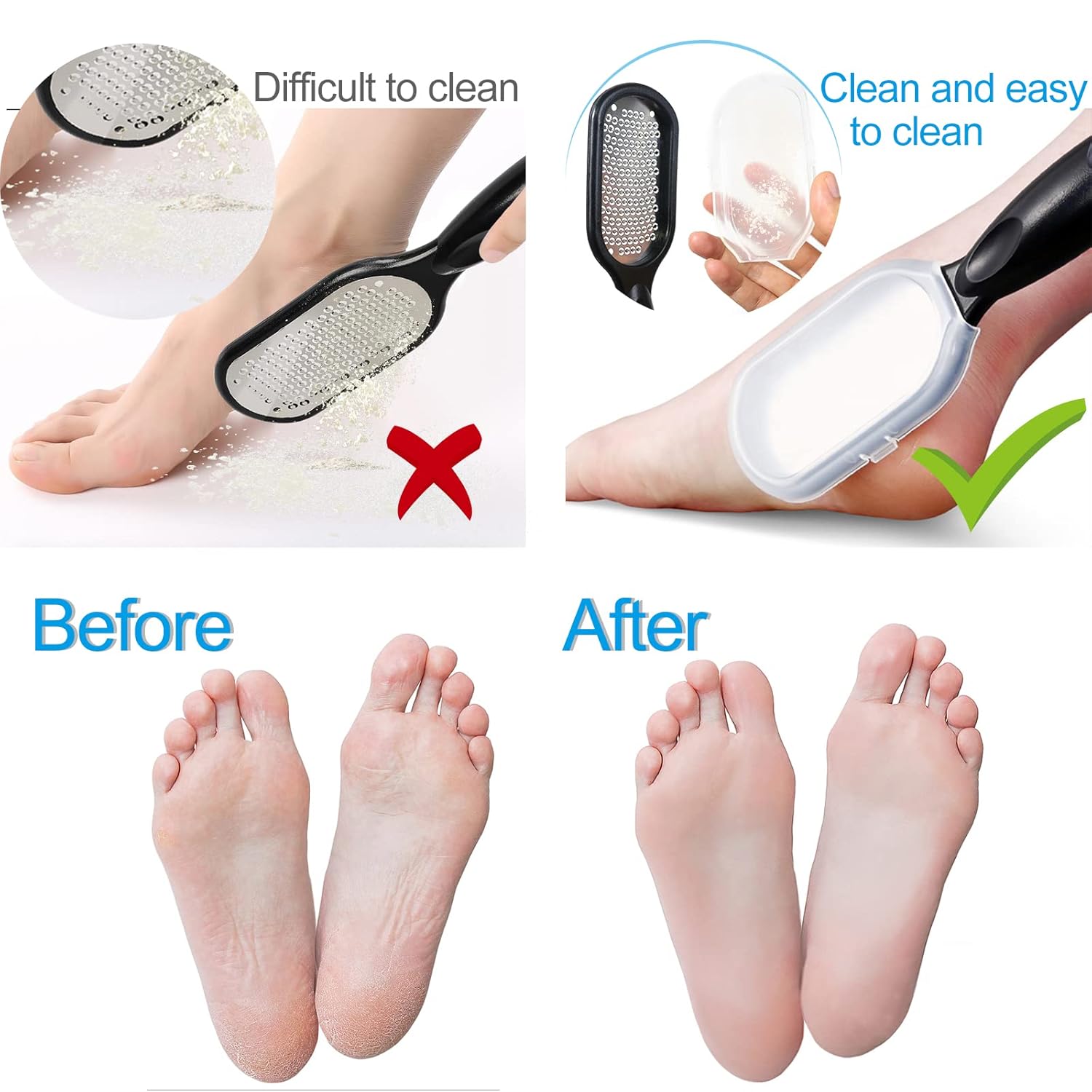 Stainless Steel Foot File