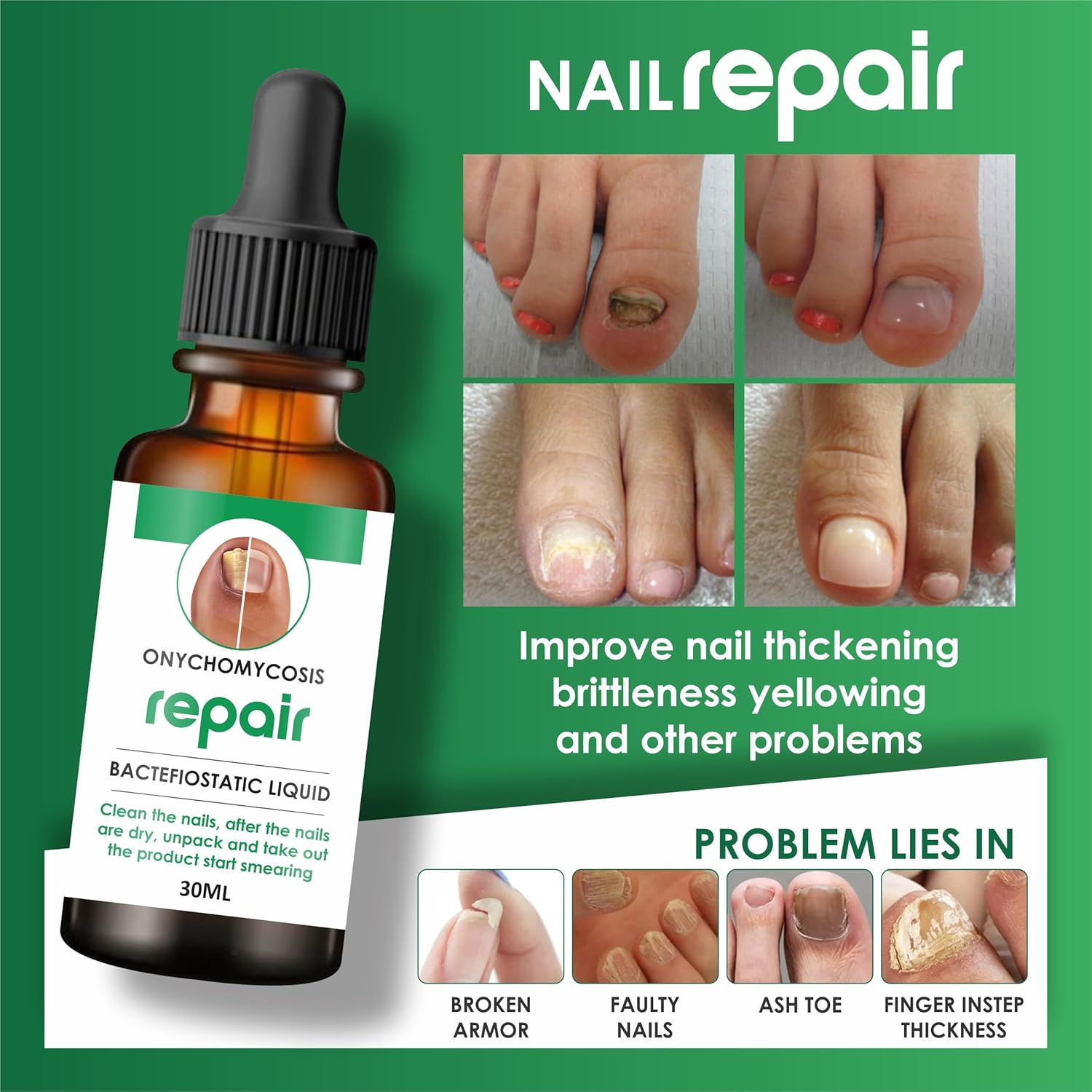 Kurizox™ Nail Serum (Pack of 2)