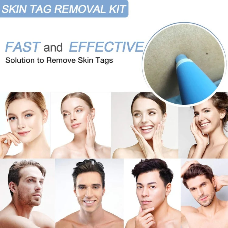Skin Tag Remover Kit