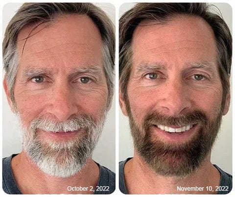 Anti-Greying Hair Darkening Serum Roposo Clout