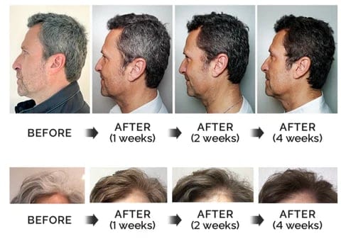 Anti-Greying Hair Darkening Serum Roposo Clout