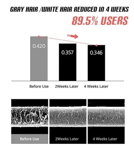 Anti-Greying Hair Darkening Serum Roposo Clout