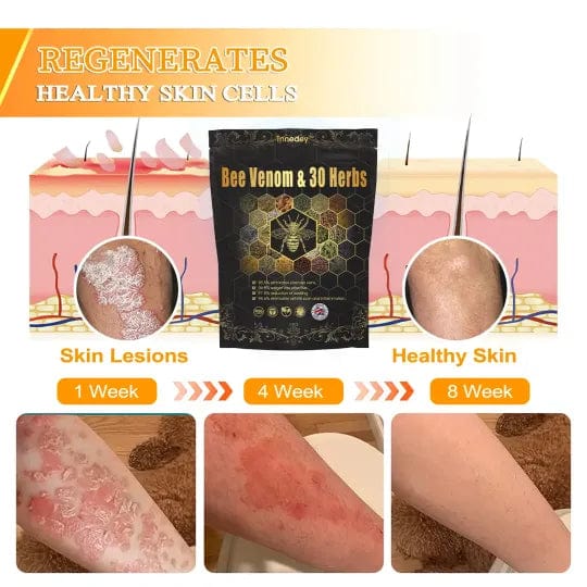 Bee Venom & 30-Herb Detox Foot Soak Beads for Body Sculpting (Buy 1 Get 1 Free🔥🔥) (Copy) Bee Venom & 30-Herb Detox Foot Soak Beads for Body Sculpting (Buy 1 Get 1 Free🔥🔥) (Copy) Zaavio®