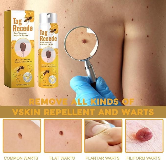 BeeClear™️ | Bee Venom Wart Remover Spray (Pack of 2) BeeClear™️ Bee Venom Wart Remover Spray (Pack of 2) Zaavio®