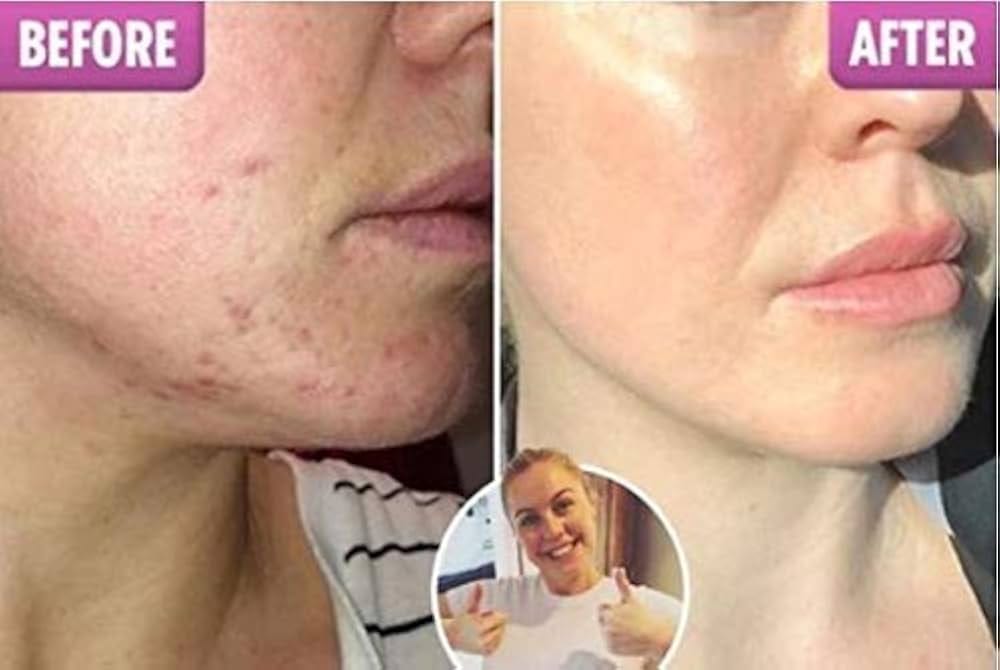 Best CC Cream for Oily and Dry Skin Beauty Face Cream - Glamoxo™ Glamoxo™ Zaavio®