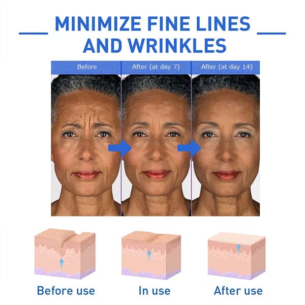 Botox Antiage Face Serum GlowRoad