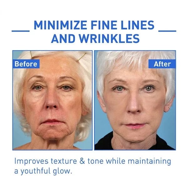Botox Antiage Face Serum Zaavio®