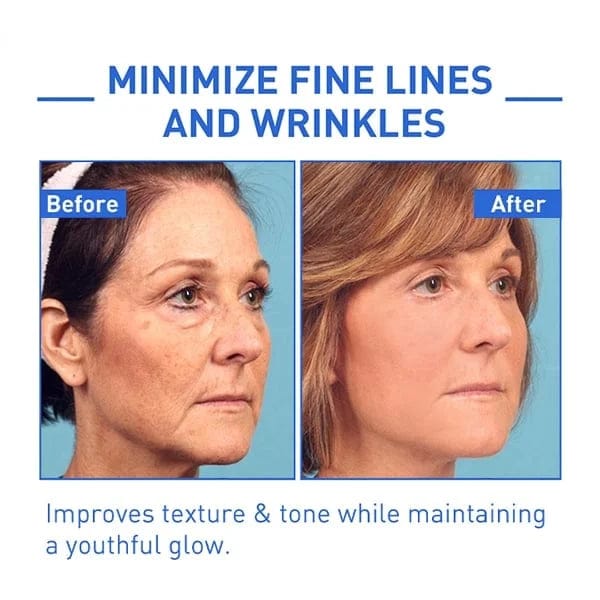Botox Antiage Face Serum Zaavio®