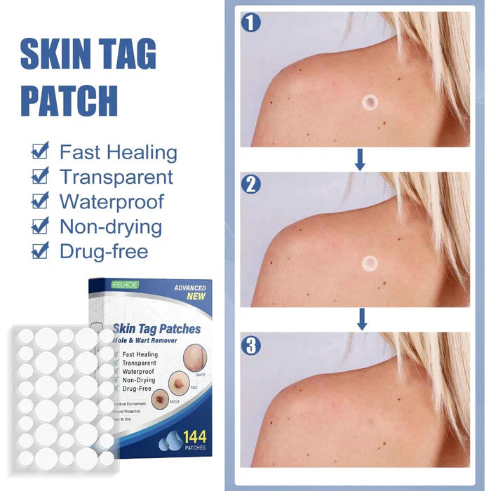 Tag Removal Patch (Pack of 72 pcs)
