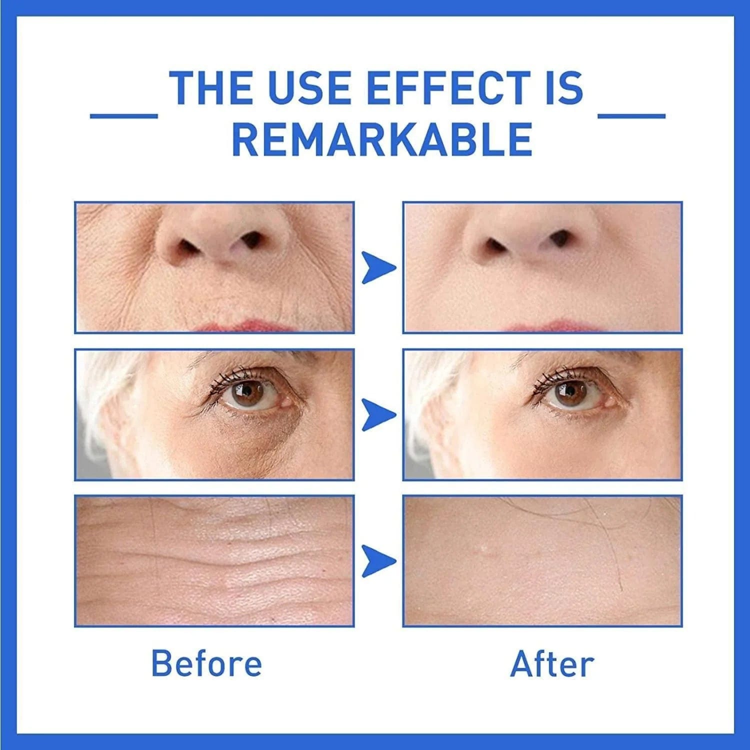 Face Serum Retinol Anti Ageing Serum Retinol For Skin - Botox Antiage Face Serum Elixiris™️ (Buy1 Get1 Free) Zaavio®️