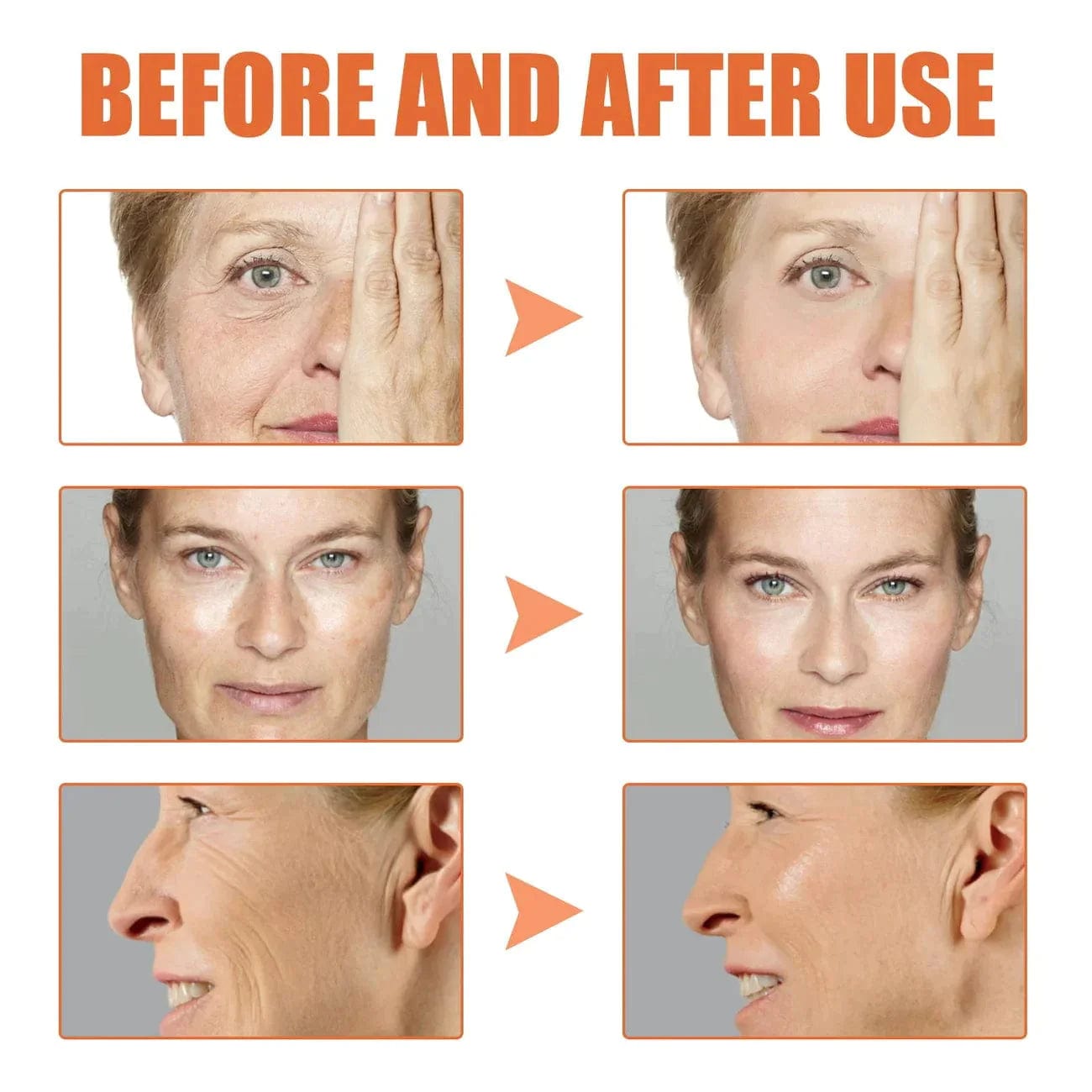 Face Serum Retinol Anti Ageing Serum Retinol For Skin - Botox Antiage Face Serum Elixiris™️ Zaavio®️
