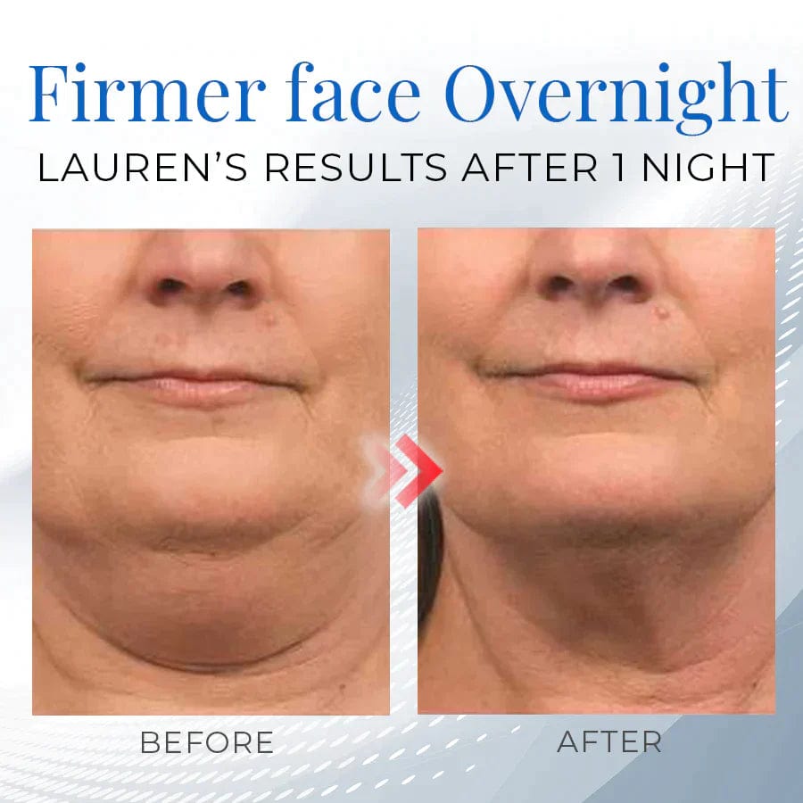 Firmio™ Sleeping V-Face Beauty Device Finess