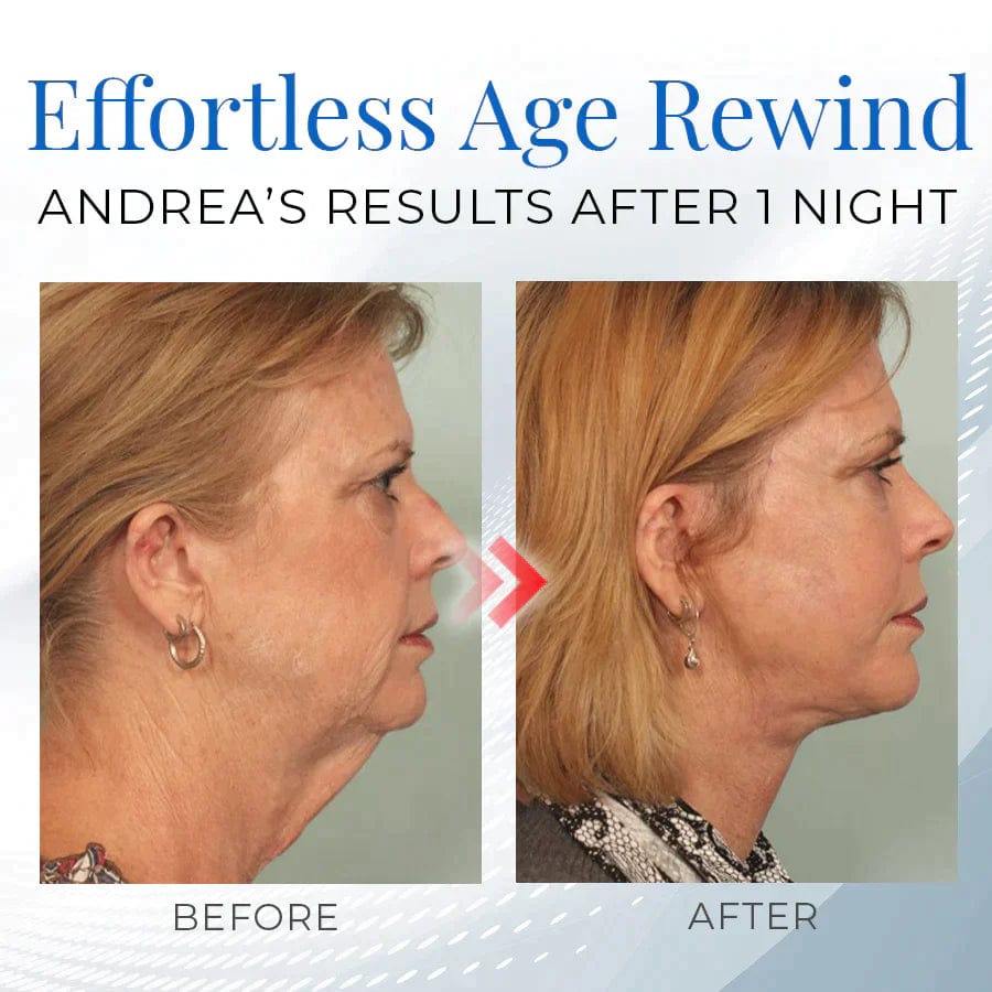 Firmio™ Sleeping V-Face Beauty Device Finess