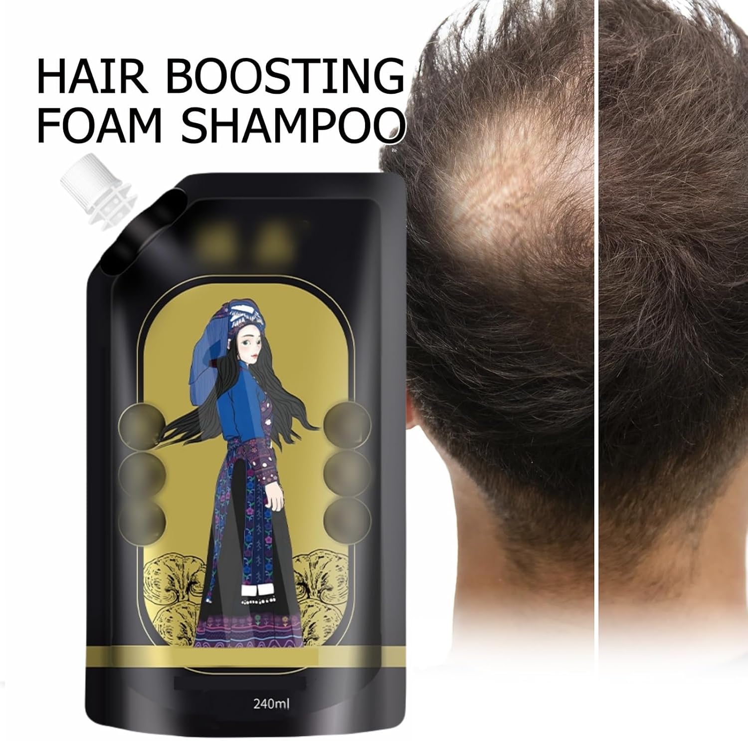 Ginger Plant Extract Anti-Hair Loss Shampoo (Pack of 3) | Anti Hair Fall Shampoo Hair Growth Ginger Hairex Reduce Hair Loss Ginger Plant Extract Anti-Hair Loss Shampoo (Pack of 3) Zaavio®