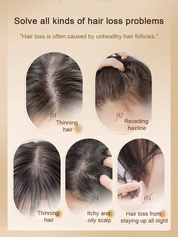 Ginger Plant Extract Anti-Hair Loss Shampoo (Pack of 3) | Anti Hair Fall Shampoo Hair Growth Ginger Hairex Reduce Hair Loss Ginger Plant Extract Anti-Hair Loss Shampoo (Pack of 3) Zaavio®