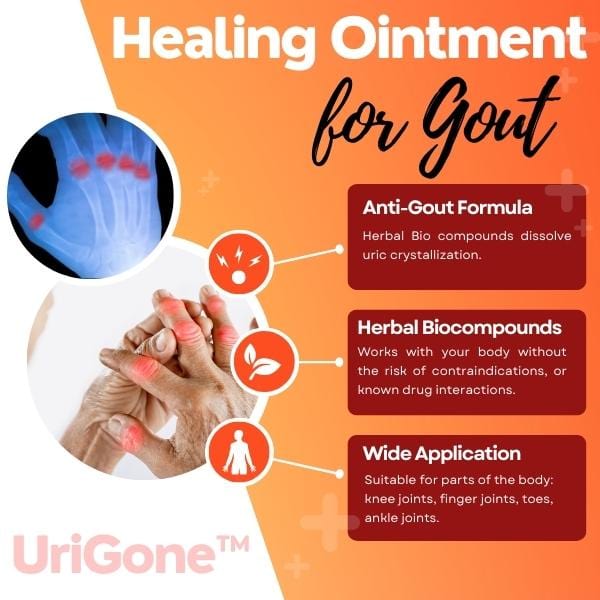 Healing Ointment for Gout mysite