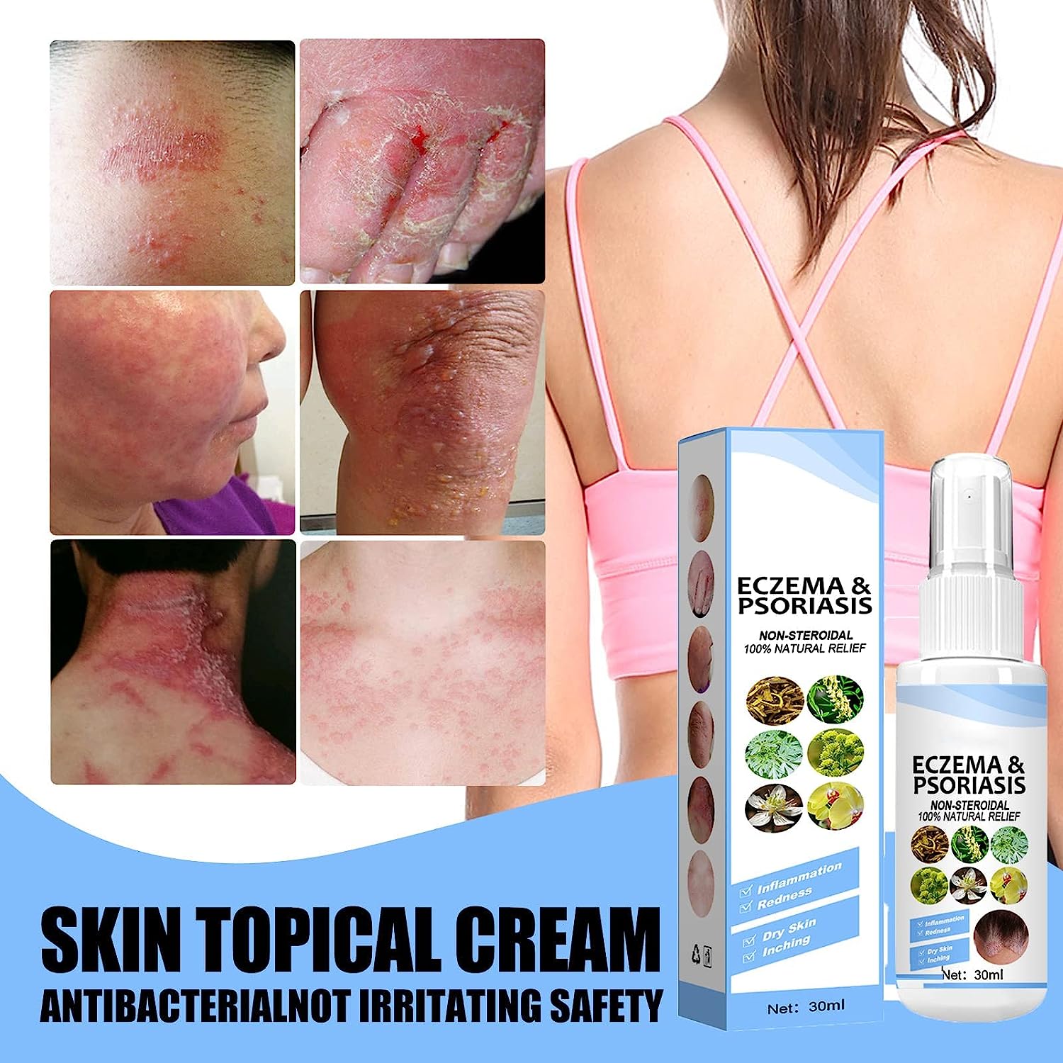 Herbal Psoriasis Relief Spray Roposo Clout