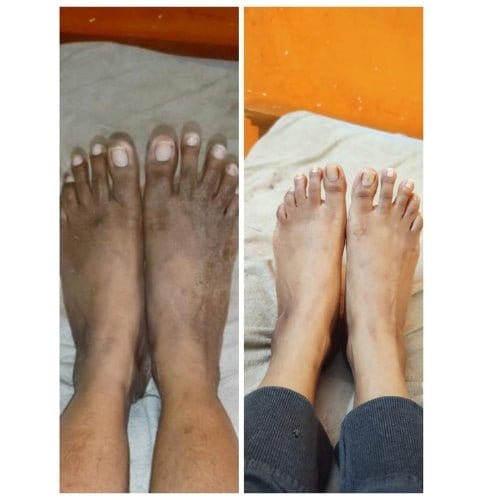 Kojic Body Soap (Buy 1 Get 2) | Skin Whitening Soap Dark Spots On Skin Tone Kojic Soap Whitening Kojic Body Soap (Buy 1 Get 2) Zaavio®
