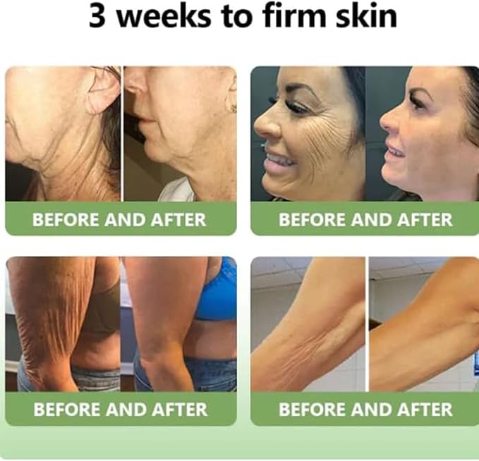 LuxeLift Collagen Firming Body Cream (Pack of 2) | Skin Firming Collagen Cream Moisturiser Body Lotion LuxeLift Collagen Firming Body Cream (Pack of 2) Zaavio®