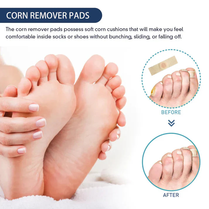 Corn Remover Pads