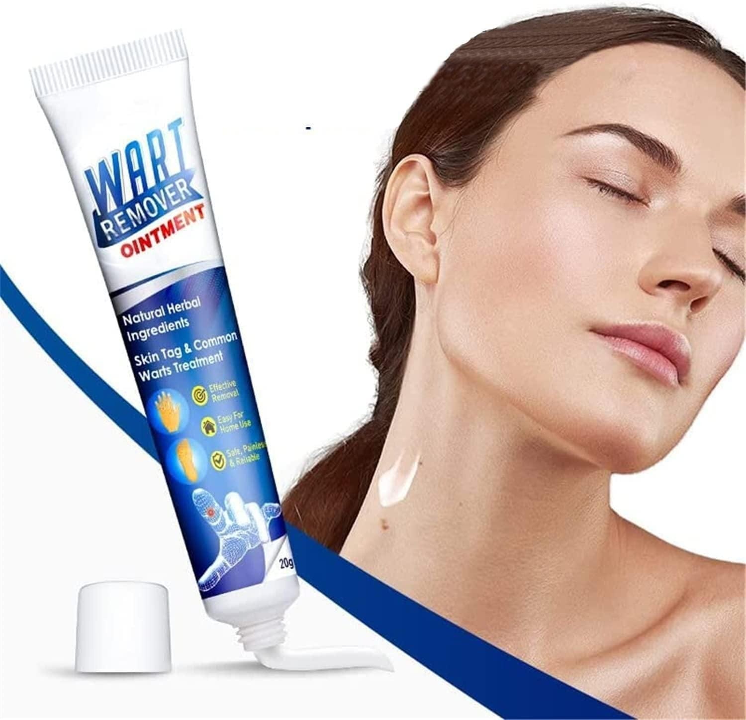 ointment 100g Warts Off Instant Blemish Removal Cream Wart Remover Ointment for All Skin Types (Pack of 1) Roposo Clout