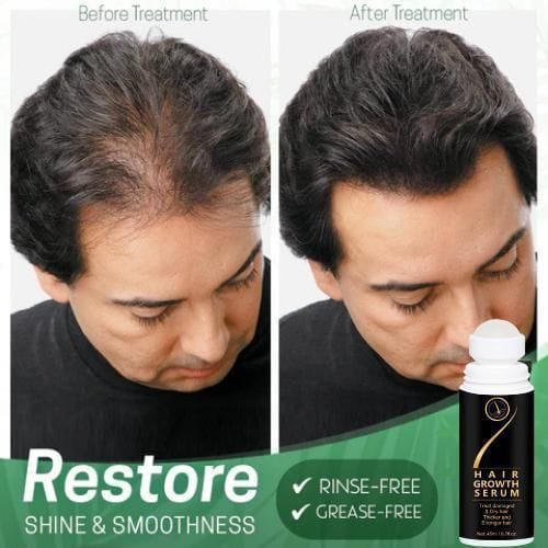 ORGANIC HAIR SERUM ROLLER (Pack of 2 ) (BUY 1 GET 1 FREE) Roposo Clout