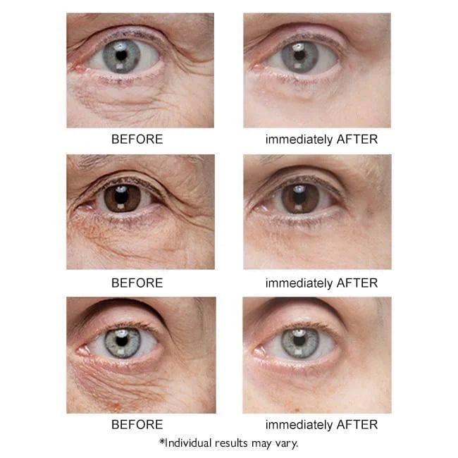 ORIGINAL™ Instant Firmx Eye Bag Cream Zaavio®