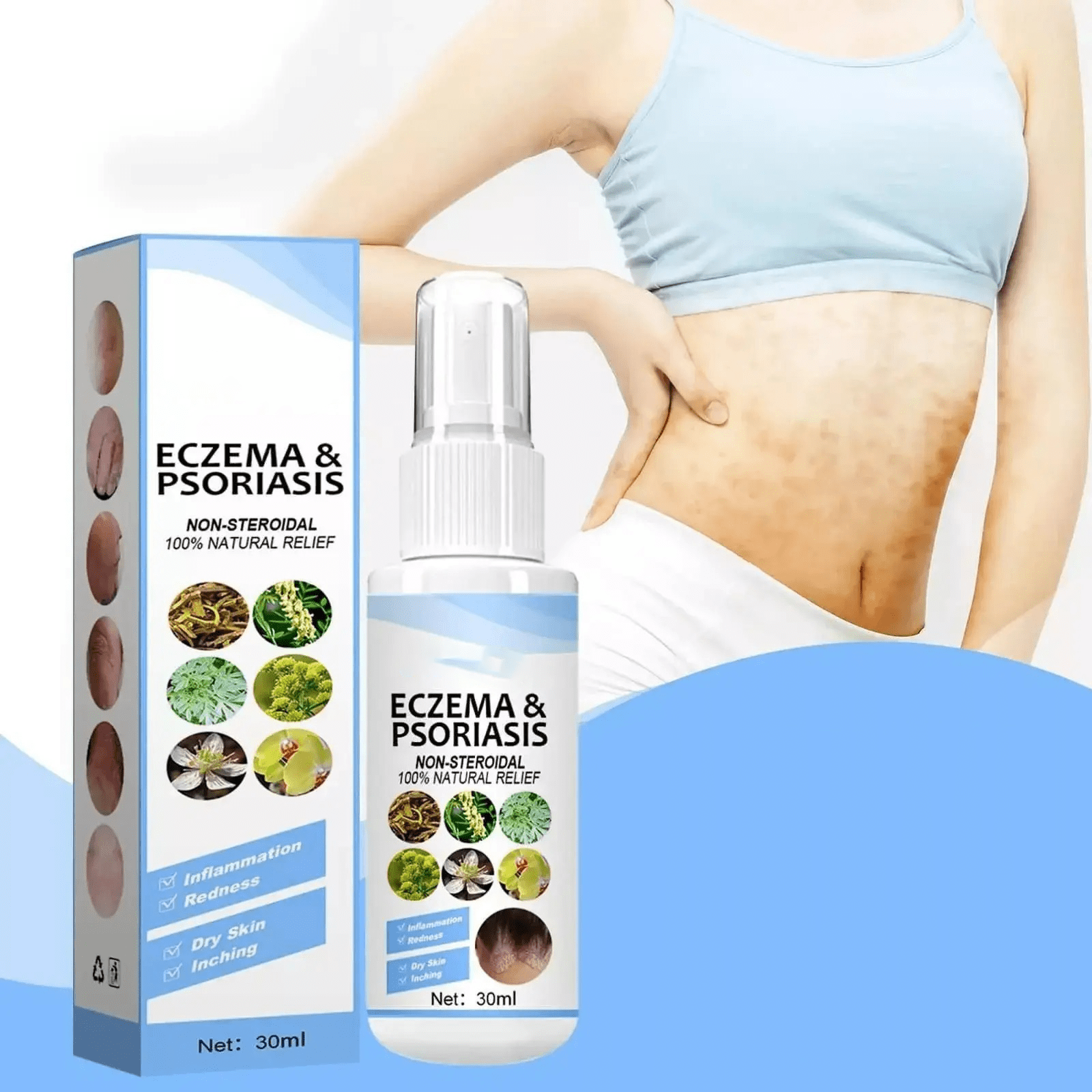 Psoriasis Treatment Vitiligo And Eczema Treatment Psoriasis Skin - PsoriHerb™️ PsoriHerb™️ Zaavio®️