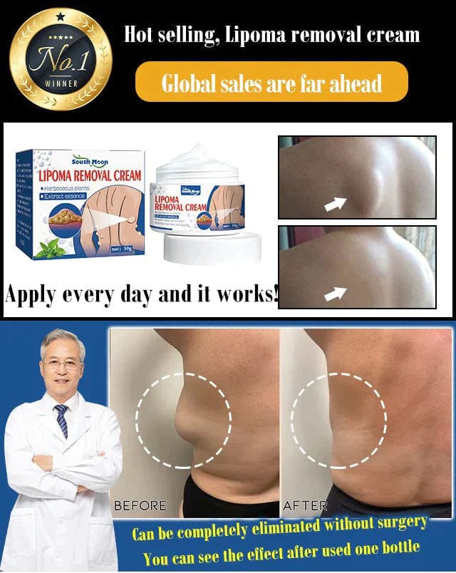Removel Cream Lipoma Herbal Removal Cream WowSmart