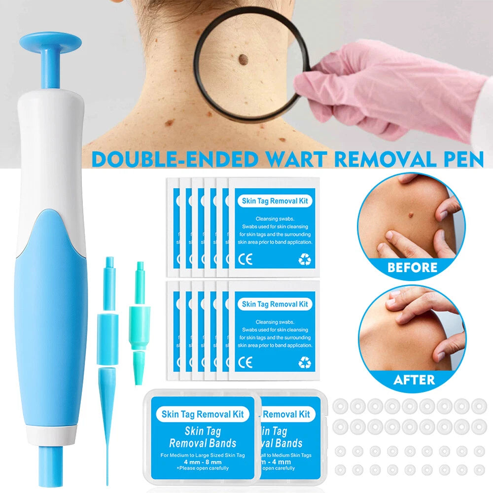 Skin Tag Remover Kit