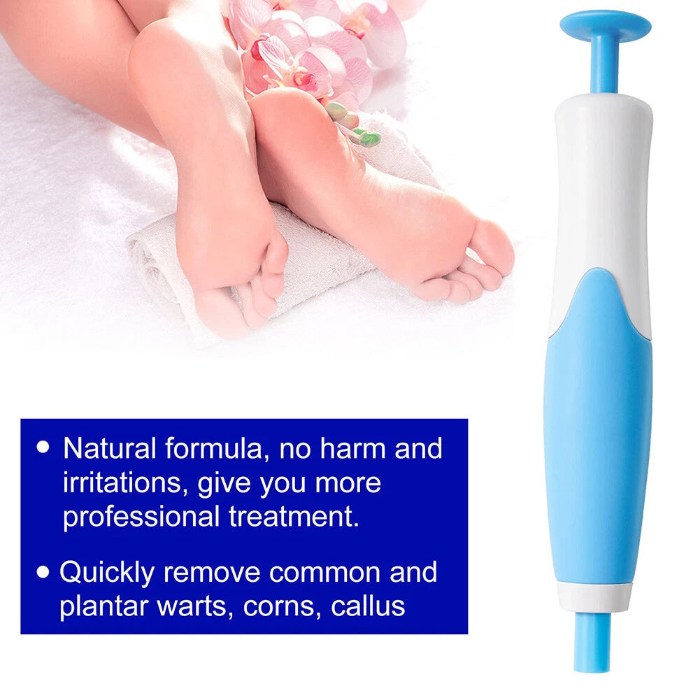 Skin Tag Remover Kit