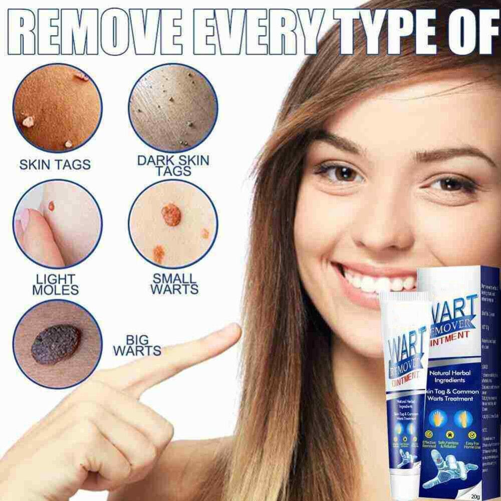 Salicylic Acid Wart Remover Black Head Removal Gel For Acne - Rejuvice™️ ointment Rejuvice™️ Zaavio®