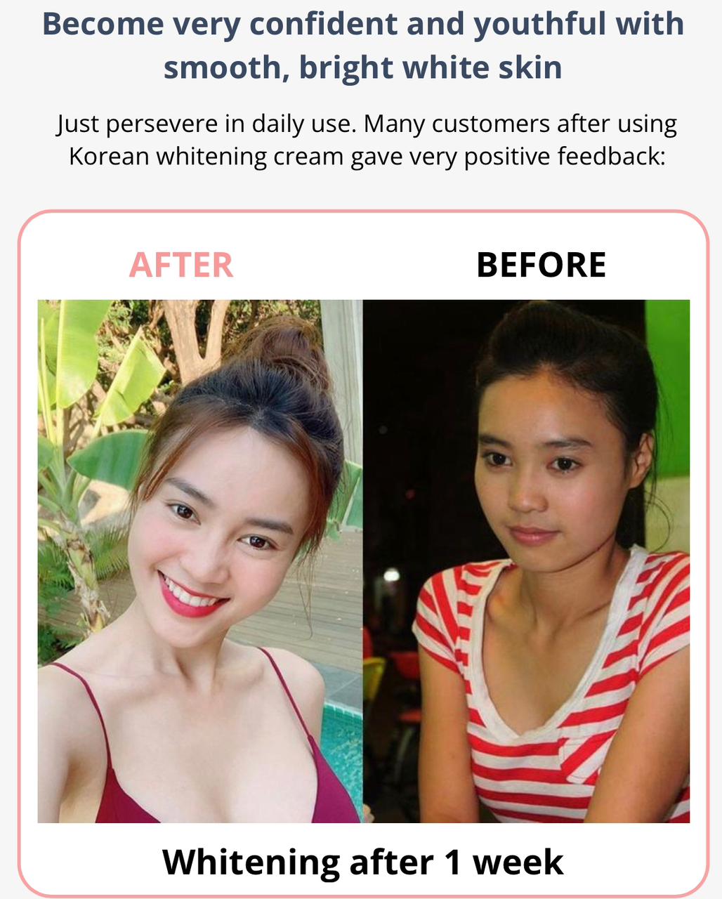 SKIN WHITENING (50% Off) Zaavio®️