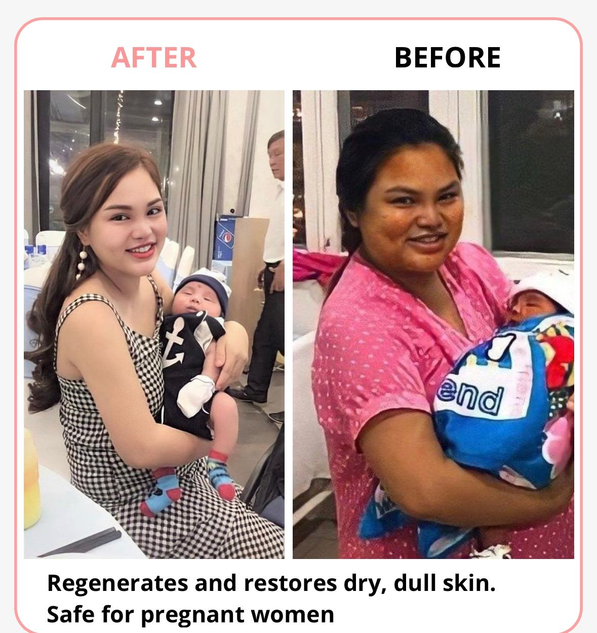 SKIN WHITENING (50% Off) Zaavio®️