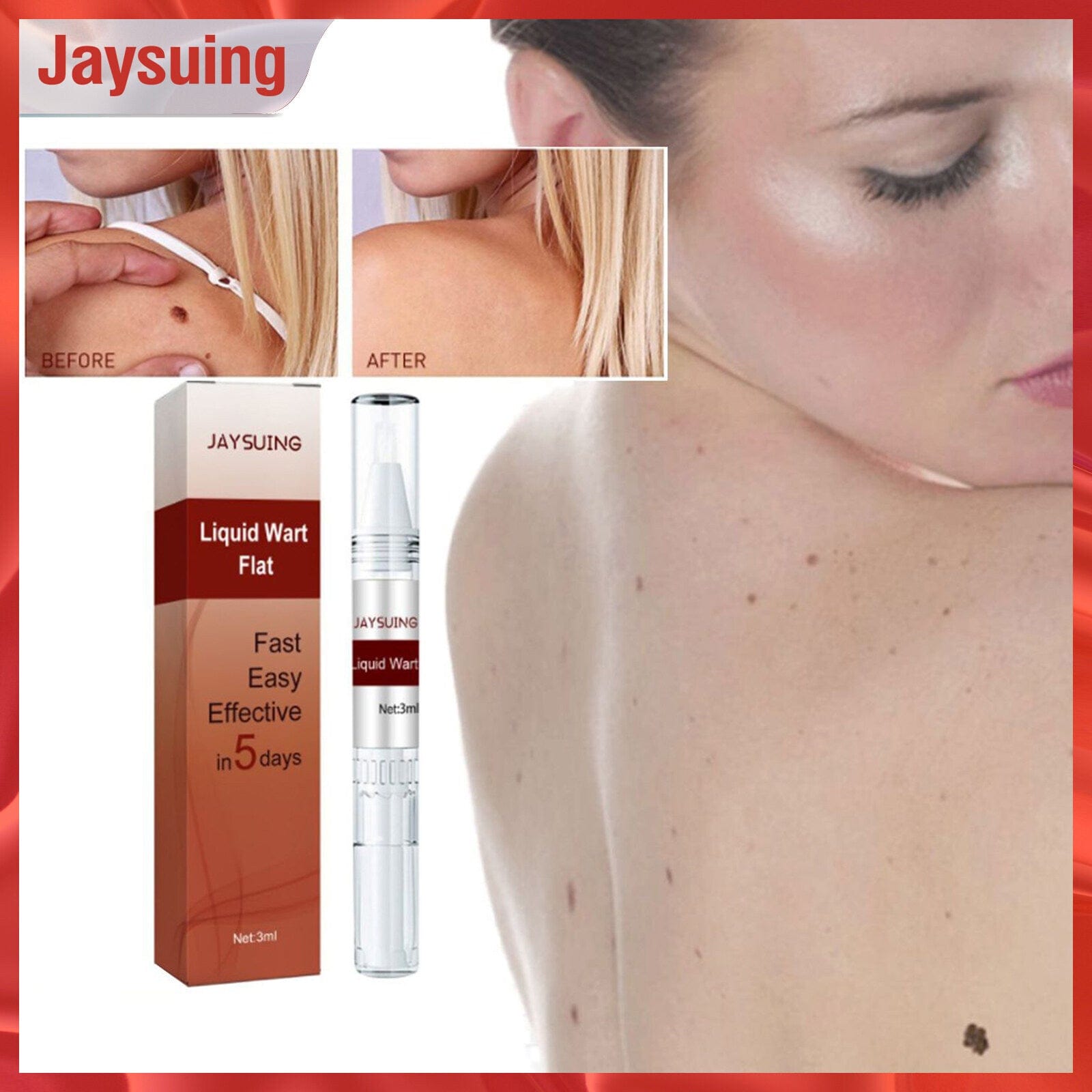Tags & Moles Remover (50% Off) Zaavio®