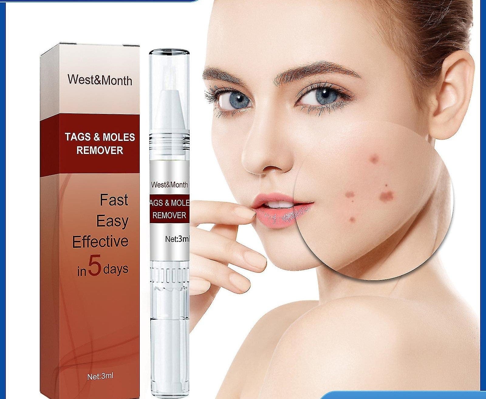 Tags & Moles Remover Zaavio®