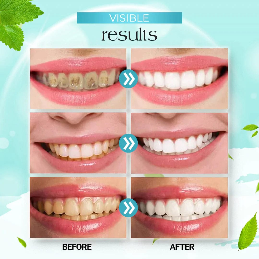 TeethPro™️ Foam Toothpaste Zaavio®
