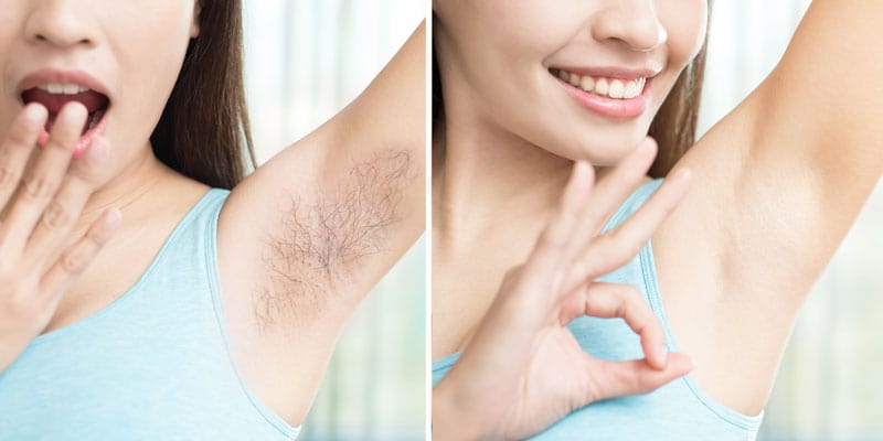 Unisex Hair Removal Gel Spray (BUY 1 GET 1 FREE) Zaavio®