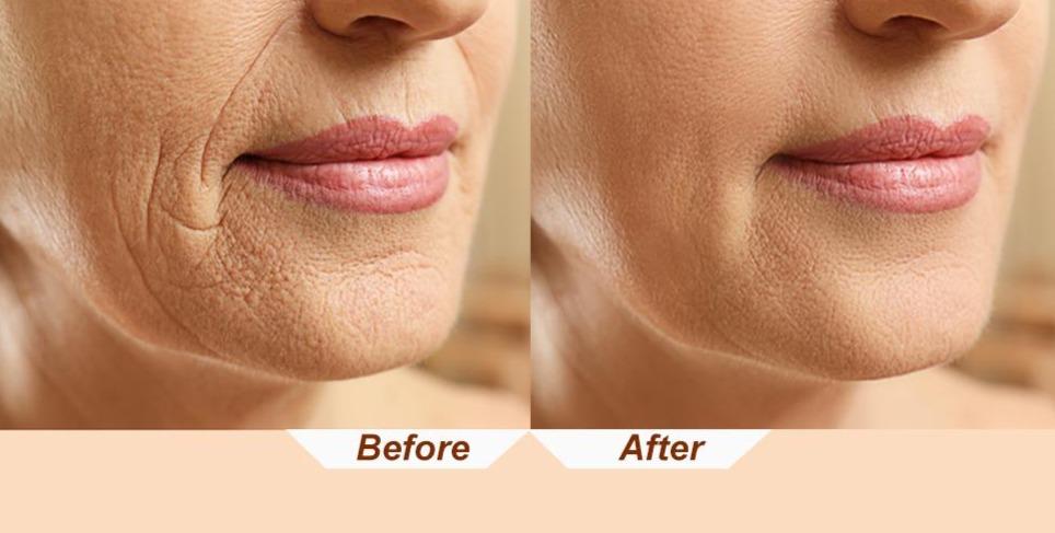 Facial Massager Ultrasonic Face Massage Tool Machine Contord™ Zaavio®