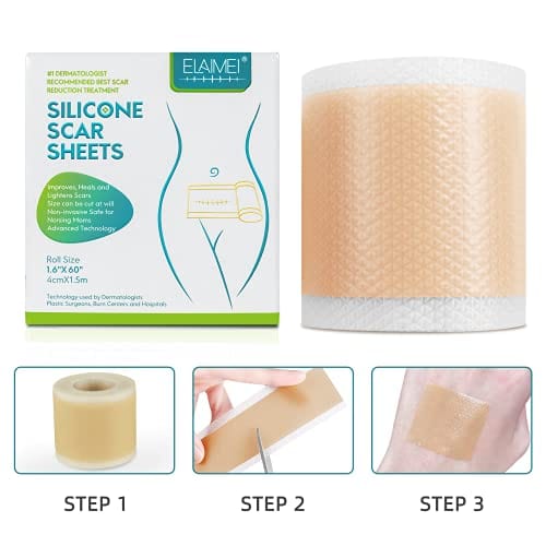 Health Medical Soft Silicone Gel Tape for Scar Removal ELAIMEI