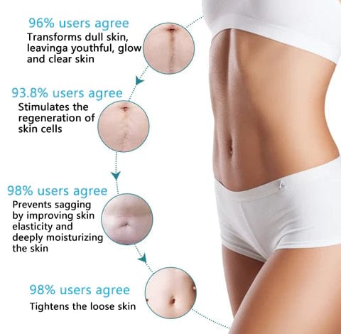 Health Medical Soft Silicone Gel Tape ELAIMEI