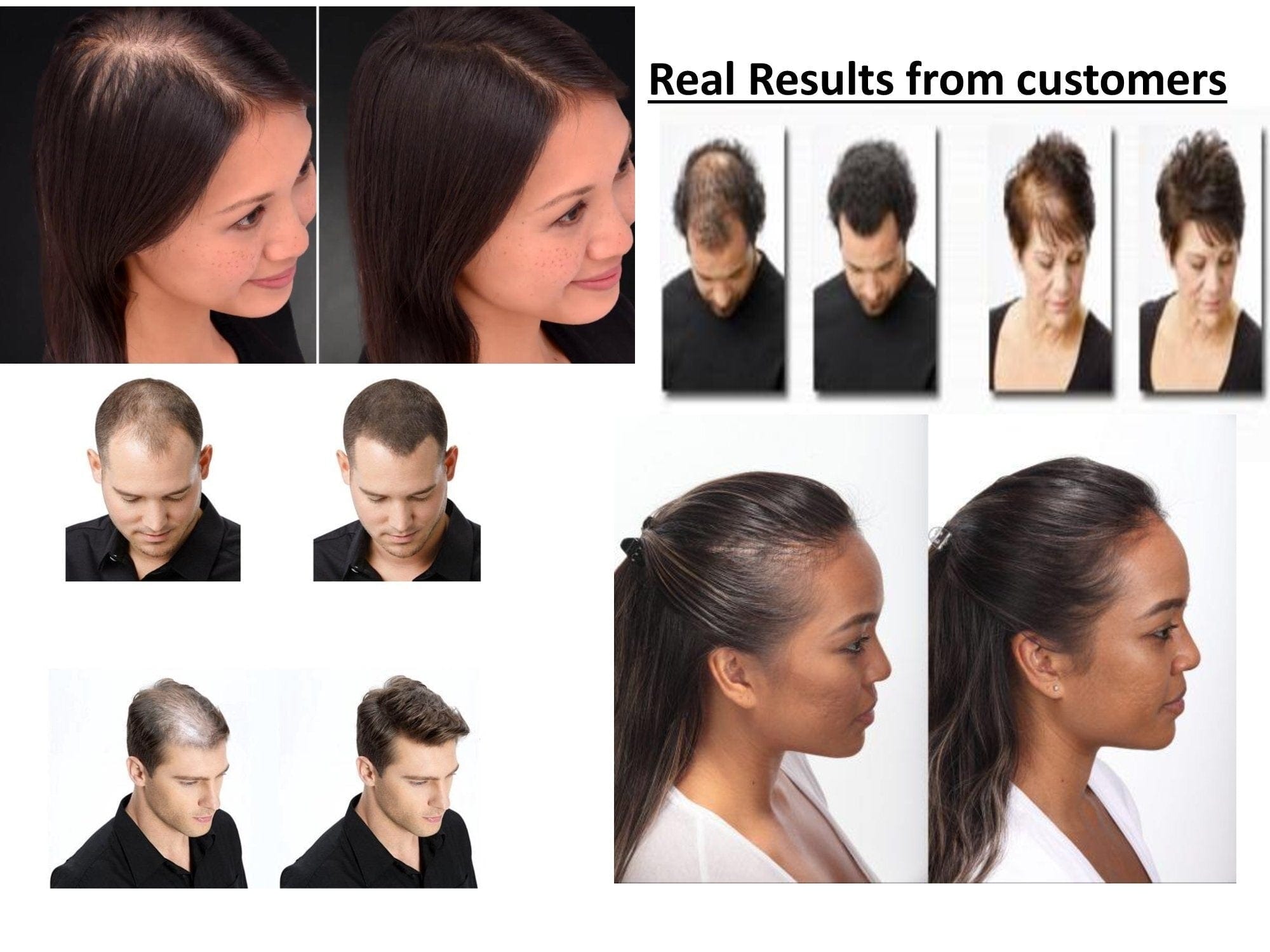 Health & Wellness Toppik Hair Building Fibers for Men & Women (Black) 27.5gm Glam Bucket IN