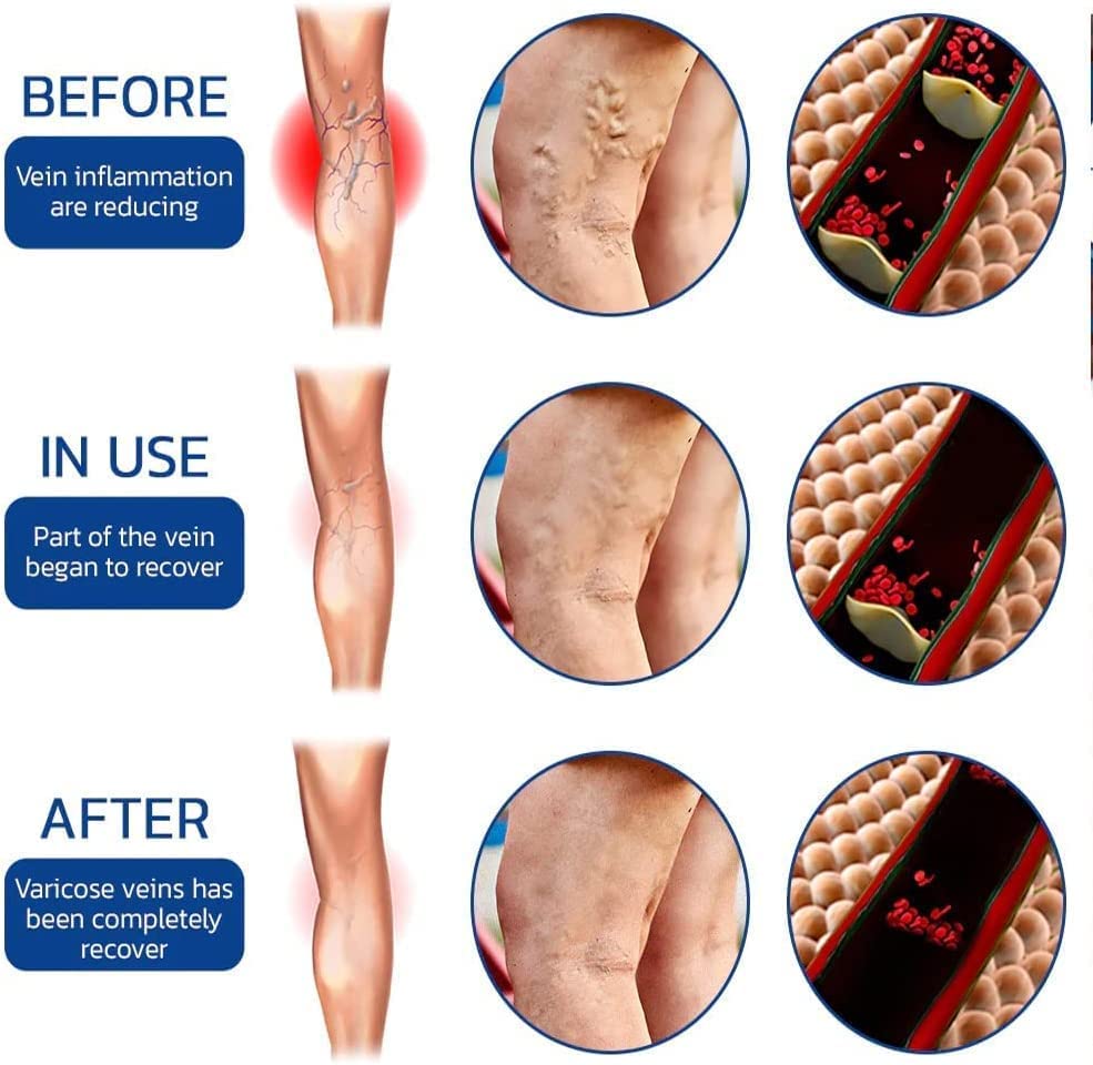 Pain Relief Oil Buy 1 Get 1 Free (Pack of 2) Roposo Clout