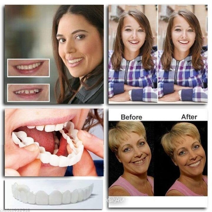 tool Adjustable Snap On Dentures fashionjun