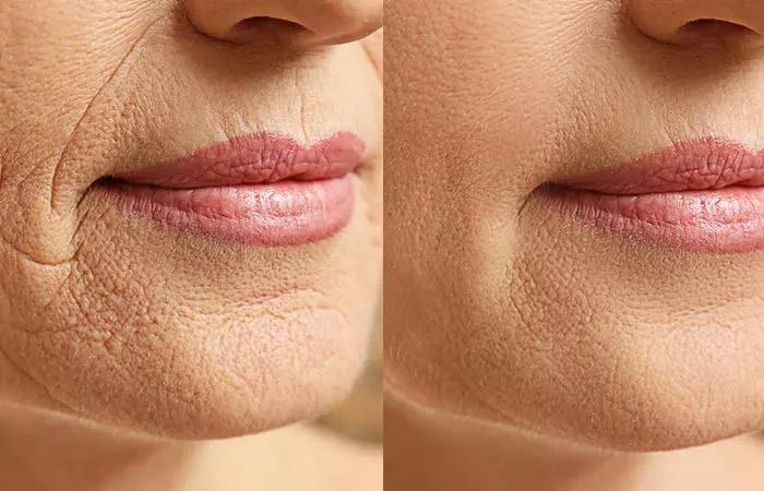 VIVIFIER™ - FACE MASSAGER Zaavio®