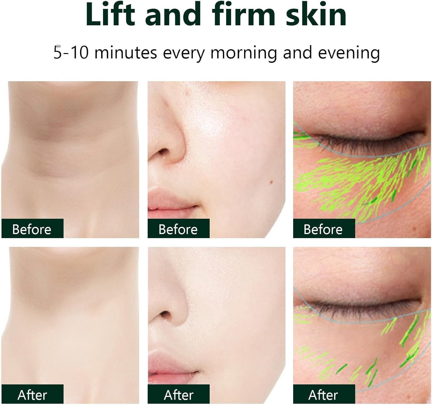 3 in 1 Face and Neck Massager | Lift Face Double Chin Removal Facial Machine Wrinkle Removal - Black - 3 in 1 Face and Neck Massager