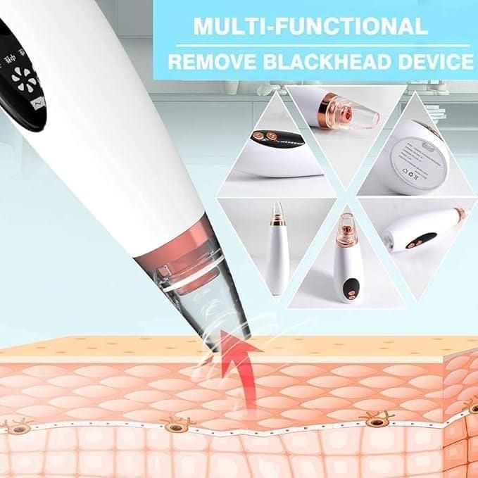 6 in 1 Multi-function Blackhead Remover Tools | Blackheads Remover Pimple Removes Open Pores Black Head Remover 6 in 1 Multi-function Blackhead Remover Tools Zaavio®