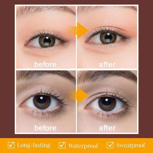 Eyelidzio™ Eyelid Shaping Pen